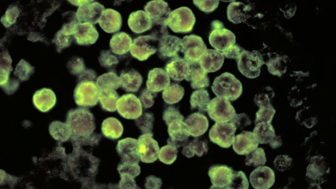 Financial Fraud: And Consumer Protection Barry Cadden Sentenced for Racketeering Leading to Nationwide Fungal Meningitis Outbreak Consumer Protection